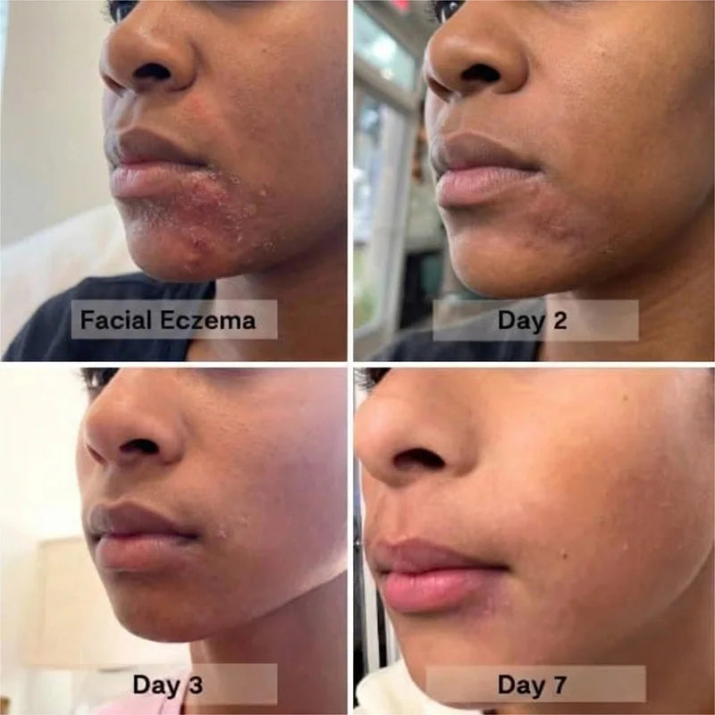 Natural Organic Balm Body Balm Moisturizer for Dry Cracked Sensitive Skin Skin Barrier Support with Skin Nourishment